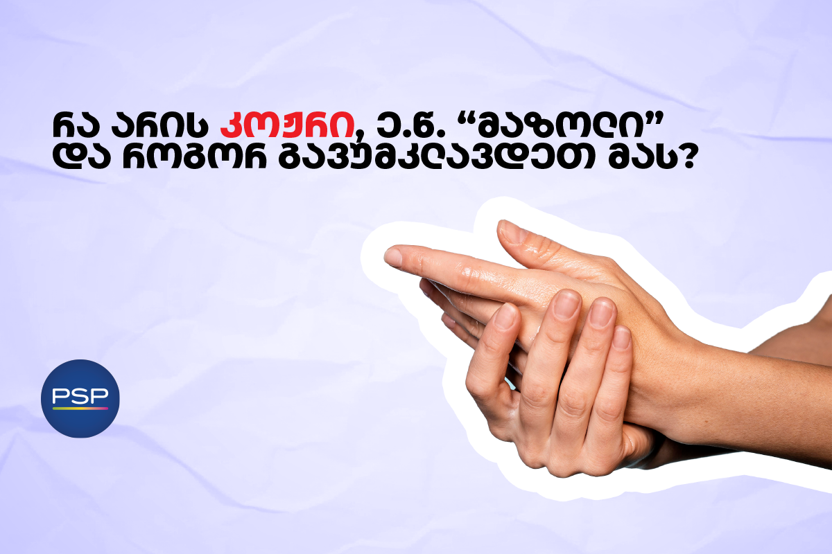 რა არის კოჟრი, ე.წ. “მაზოლი” და როგორ გავუმკლავდეთ მას? 