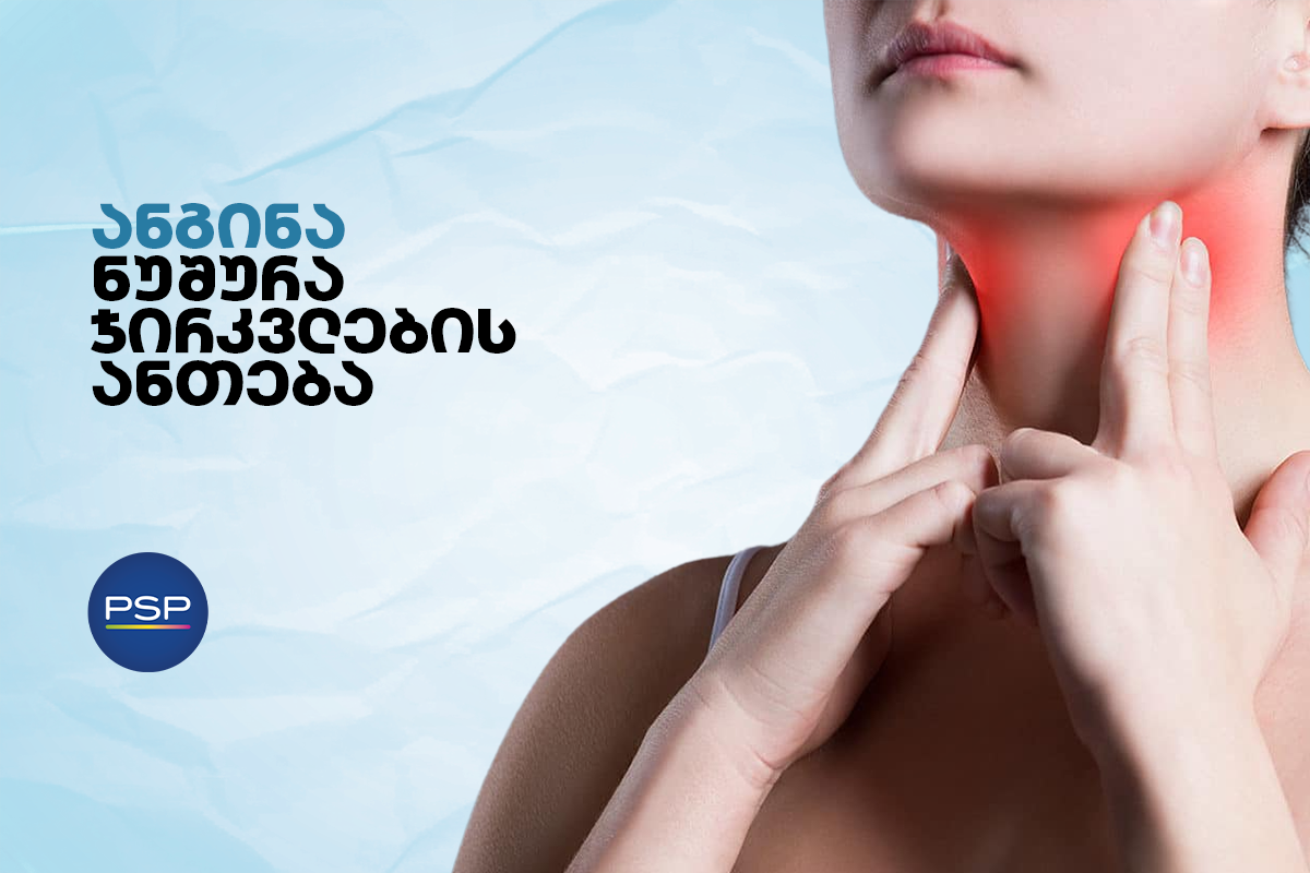 ანგინა - ნუშურა ჯირკვლების ანთება