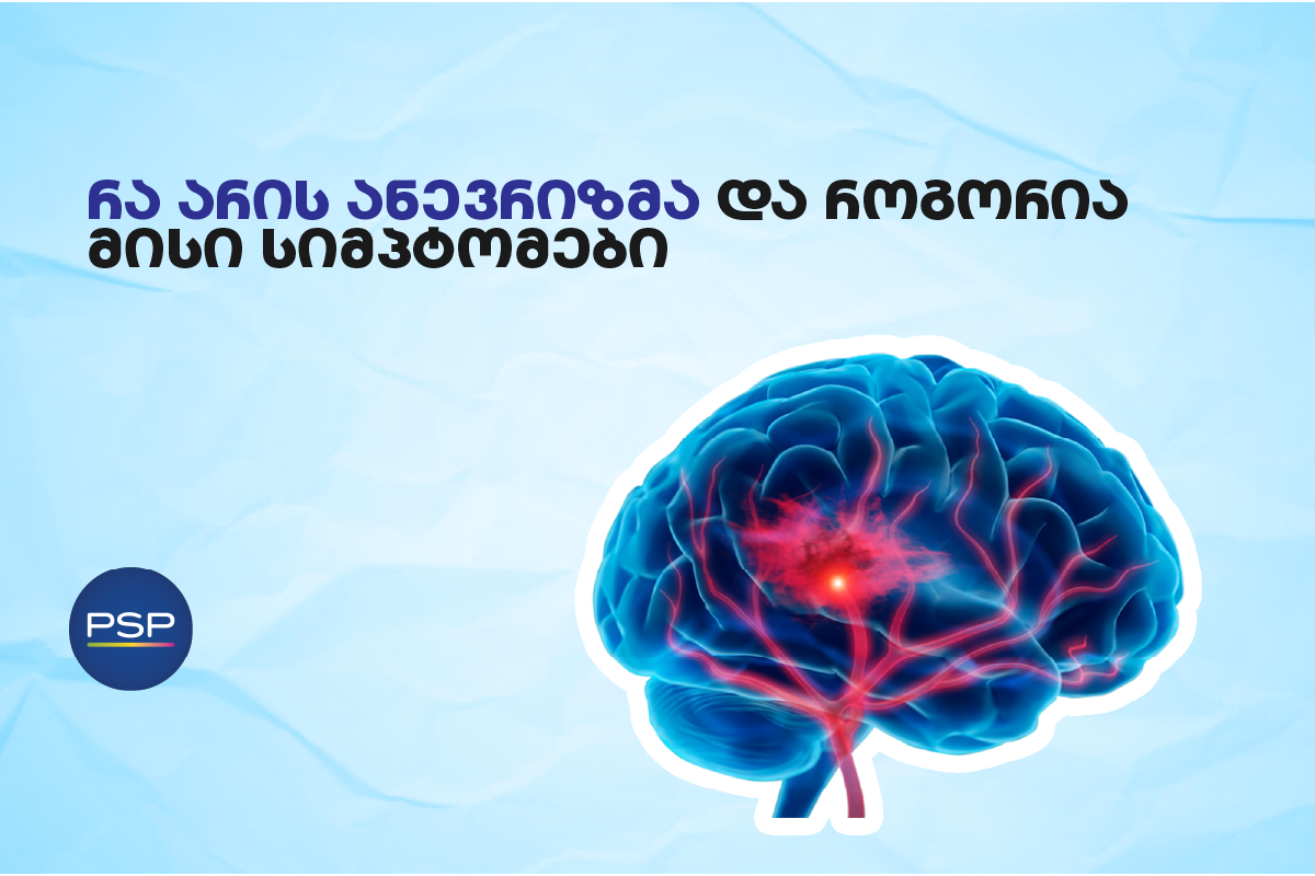 რა არის ანევრიზმა და როგორია მისი სიმპტომები 