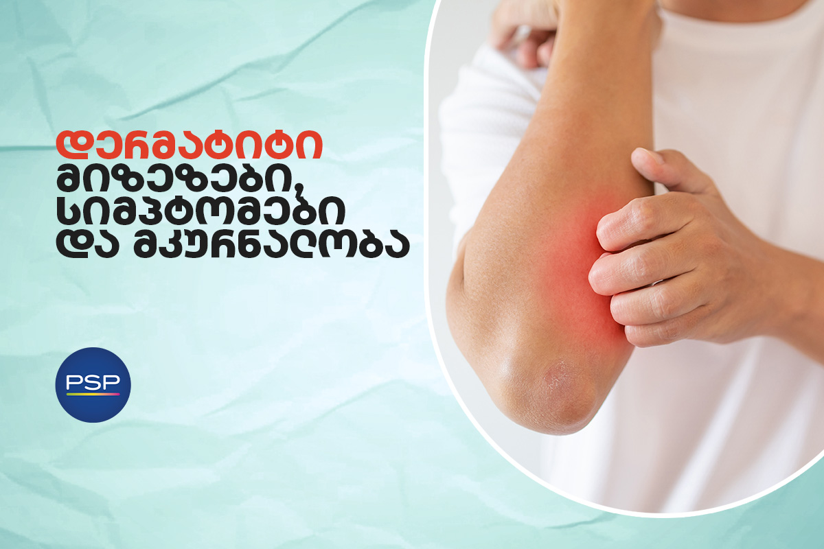 დერმატიტი - გავრცელებული კანის პრობლემა