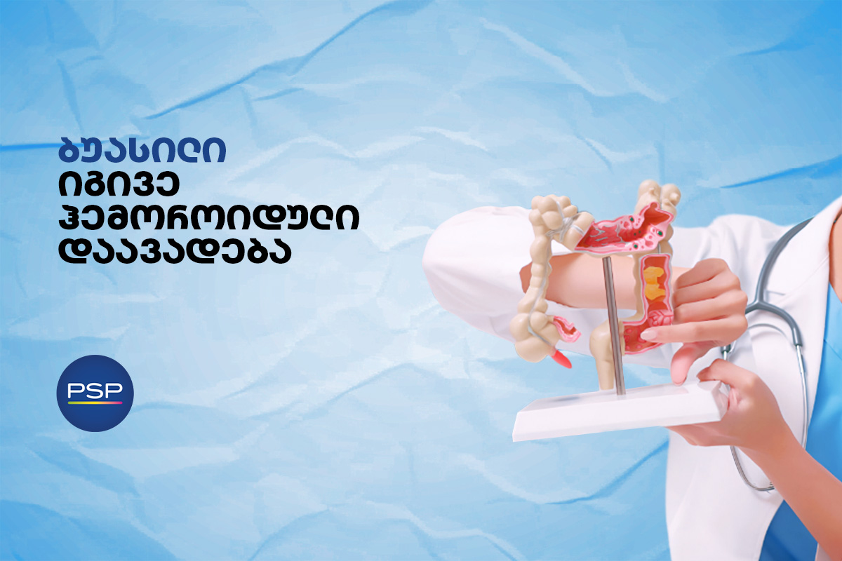 ბუასილი, იგივე ჰემოროიდული დაავადება