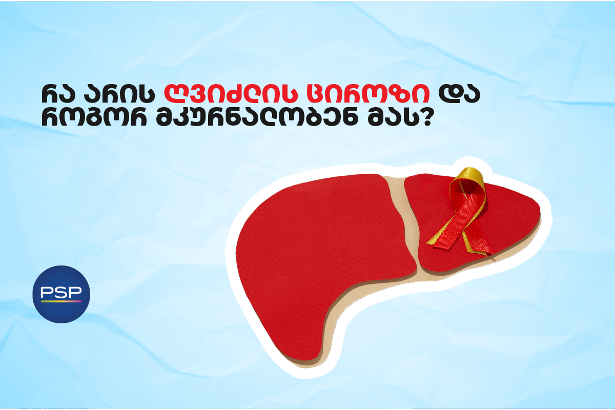 რა არის ღვიძლის ციროზი და როგორ მკურნალობენ მას? 