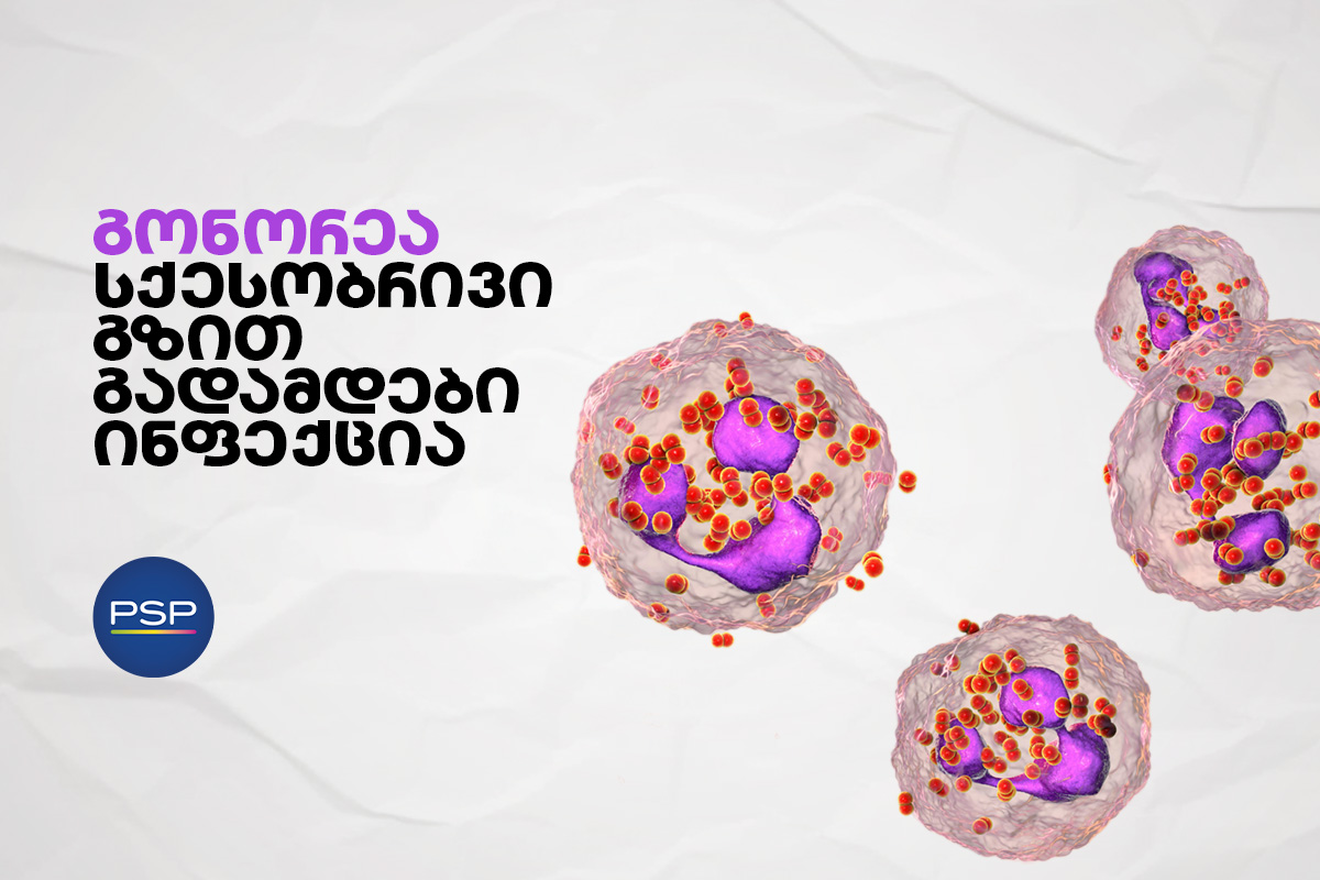 გონორეა - სქესობრივი გზით გადამდები ინფექცია