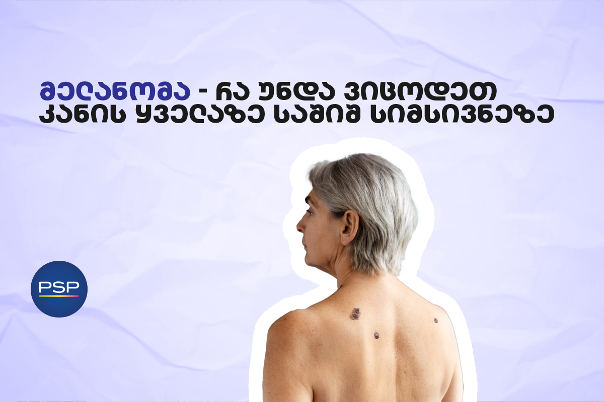 მელანომა — რა უნდა ვიცოდეთ კანის ყველაზე საშიშ სიმსივნეზე