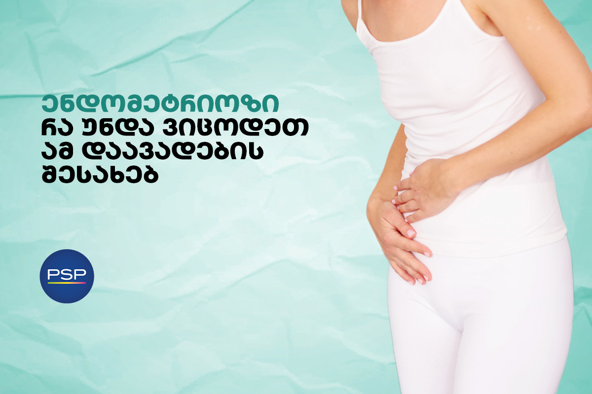 ენდომეტრიოზი - რა უნდა ვიცოდეთ ამ დაავადების შესახებ