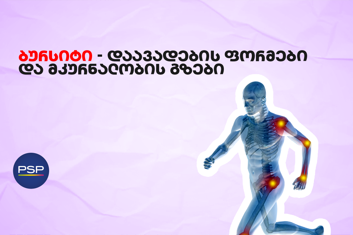 ბურსიტი — დაავადების ფორმები და მკურნალობის გზები