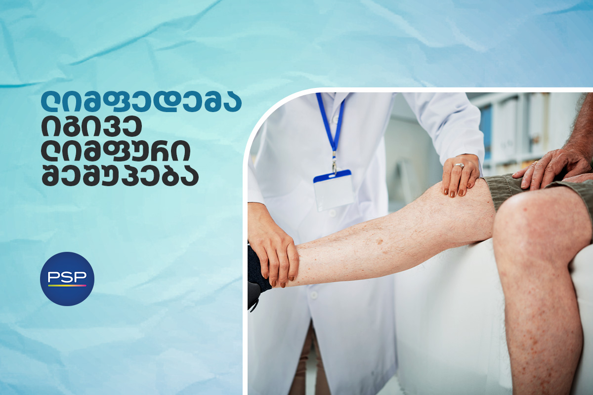 ლიმფედემა, იგივე ლიმფური შეშუპება