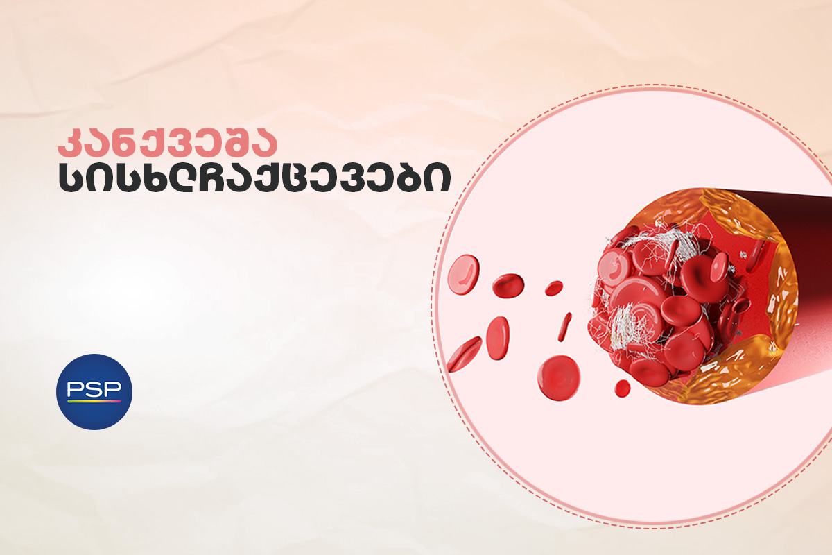 კანქვეშა სისხლჩაქცევები 