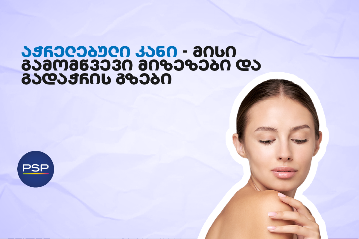 აჭრელებული კანი — მისი გამომწვევი მიზეზები და გადაჭრის გზები 