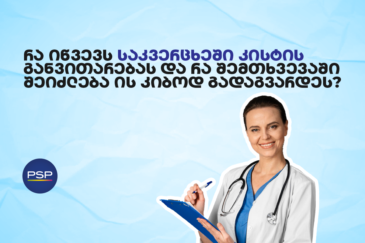 რა იწვევს საკვერცხეში კისტის განვითარებას და რა შემთხვევაში შეიძლება ის კიბოდ გადაგვარდეს?