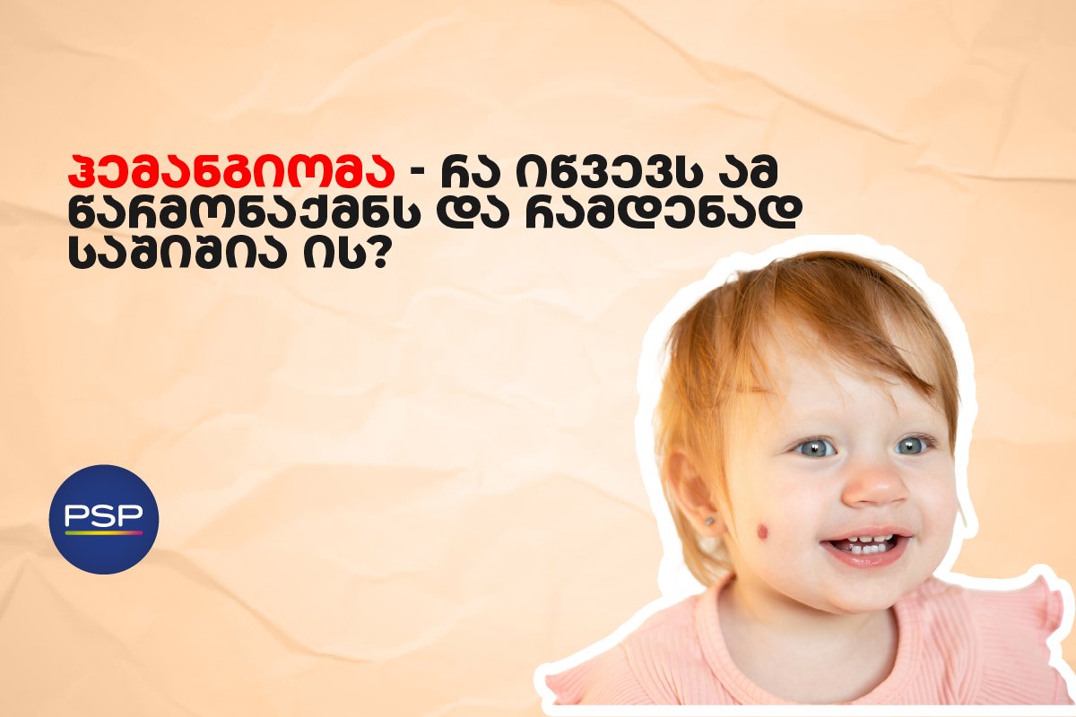 ჰემანგიომა — რა იწვევს ამ წარმონაქმნს და რამდენად საშიშია ის?