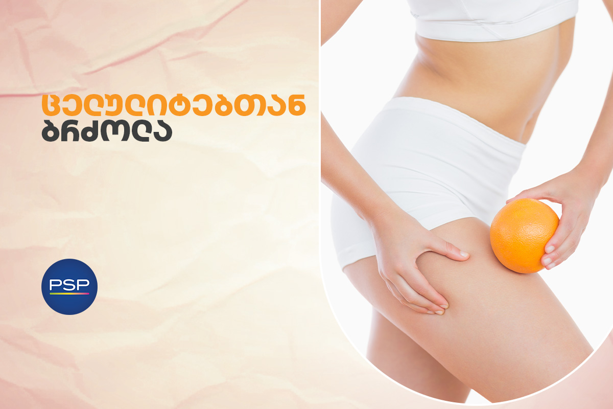 ცელულიტებთან ბრძოლა