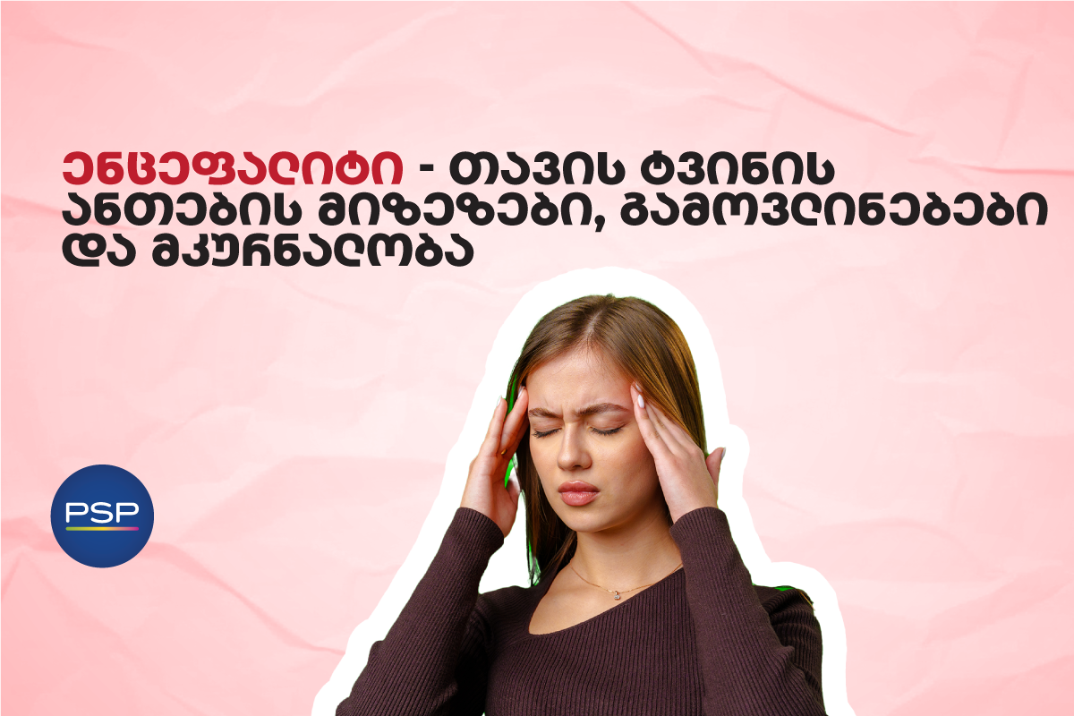 ენცეფალიტი – თავის ტვინის ანთების მიზეზები, გამოვლინებები და მკურნალობა