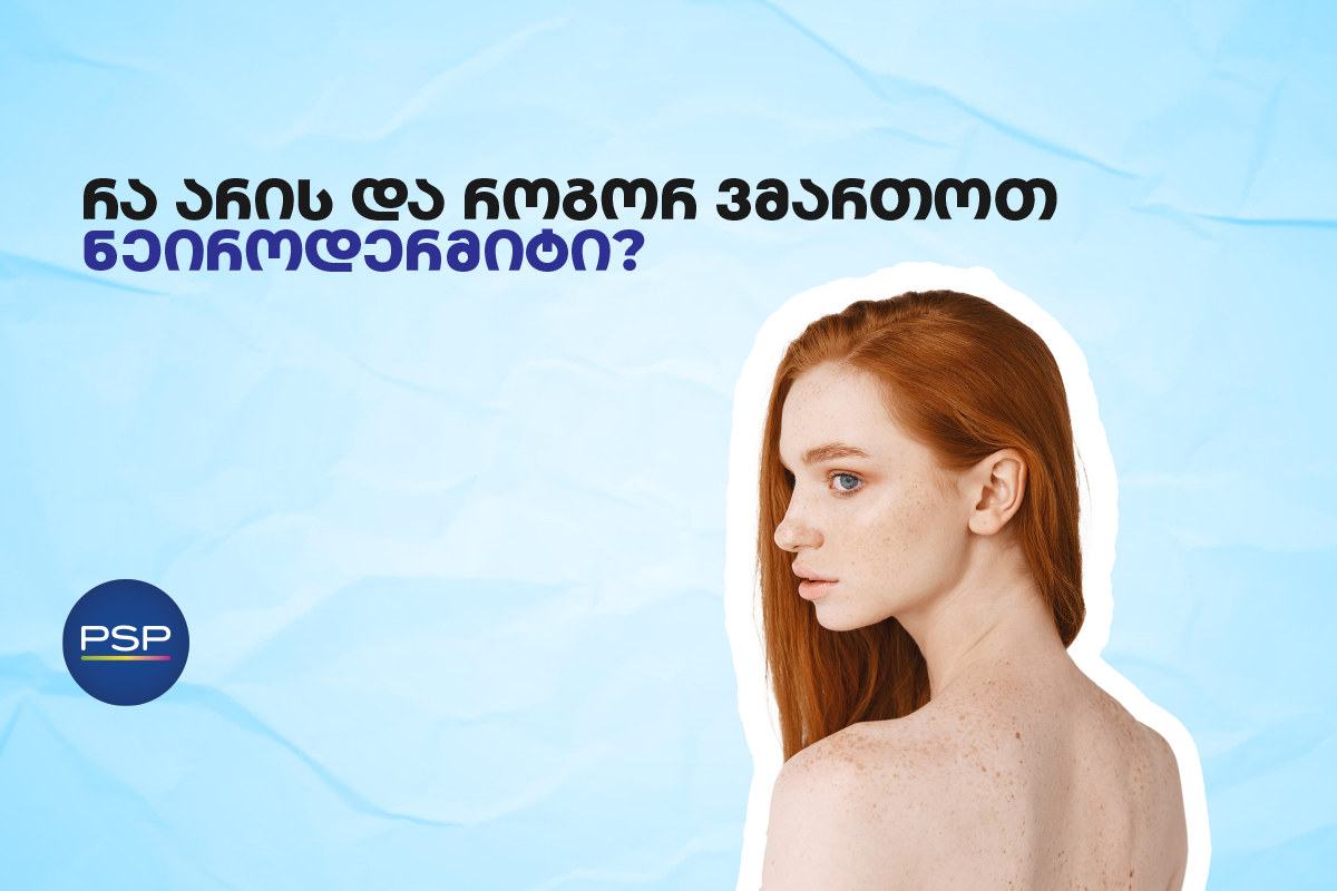 რა არის და როგორ ვმართოთ ნეიროდერმიტი? 