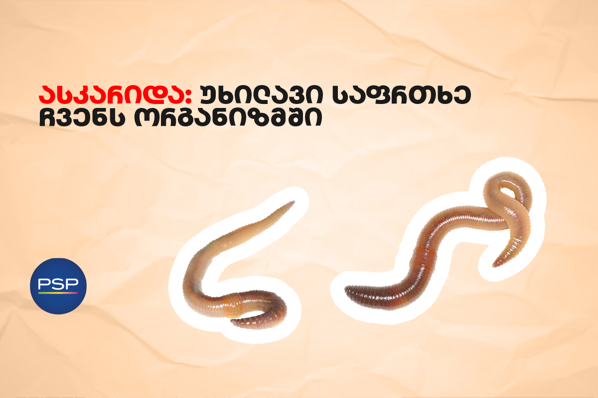 ასკარიდა: უხილავი საფრთხე ჩვენს ორგანიზმში 