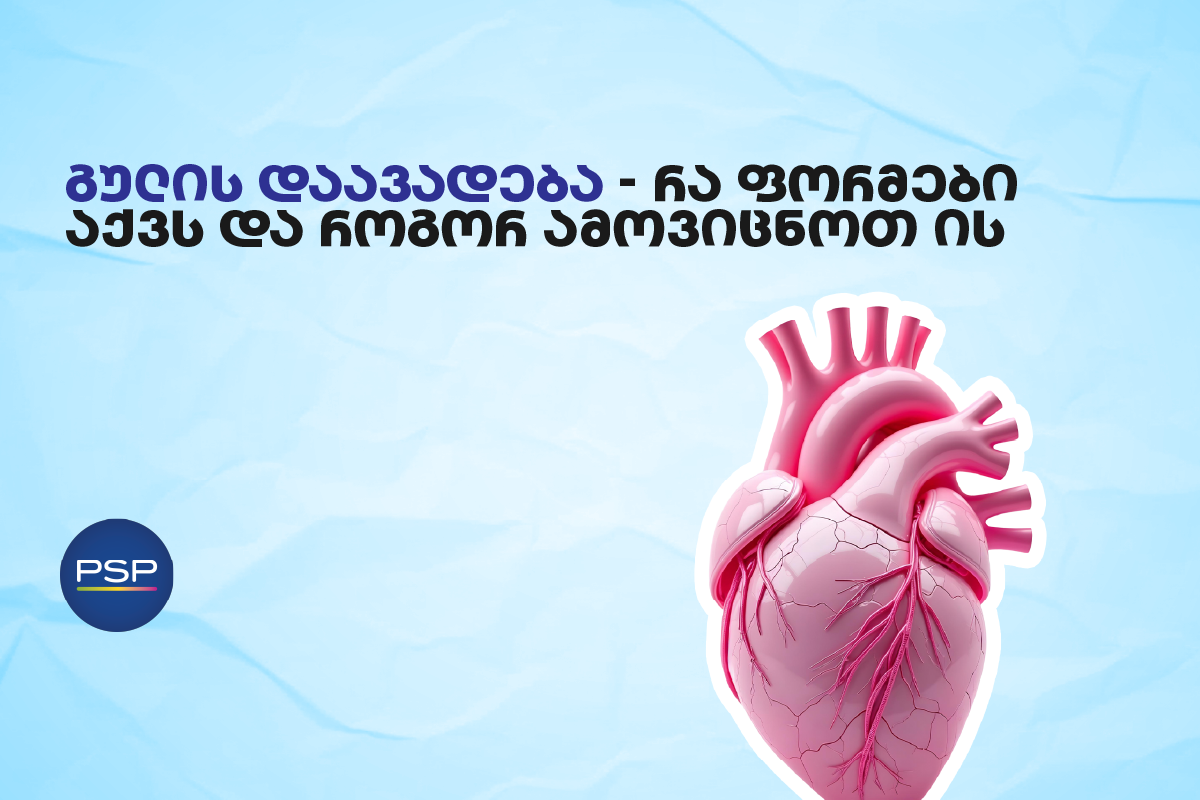 გულის დაავადება — რა ფორმები აქვს და როგორ ამოვიცნოთ ის 