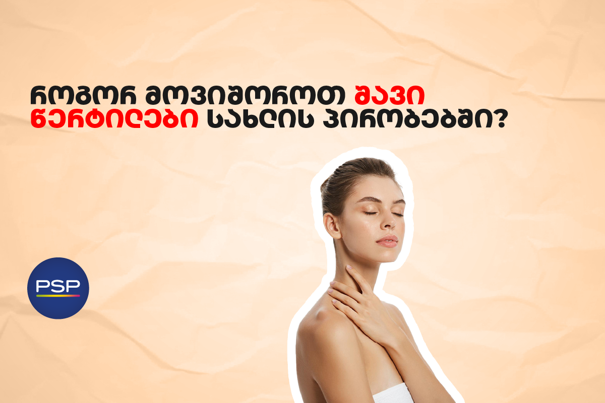 როგორ მოვიშოროთ შავი წერტილები სახლის პირობებში?