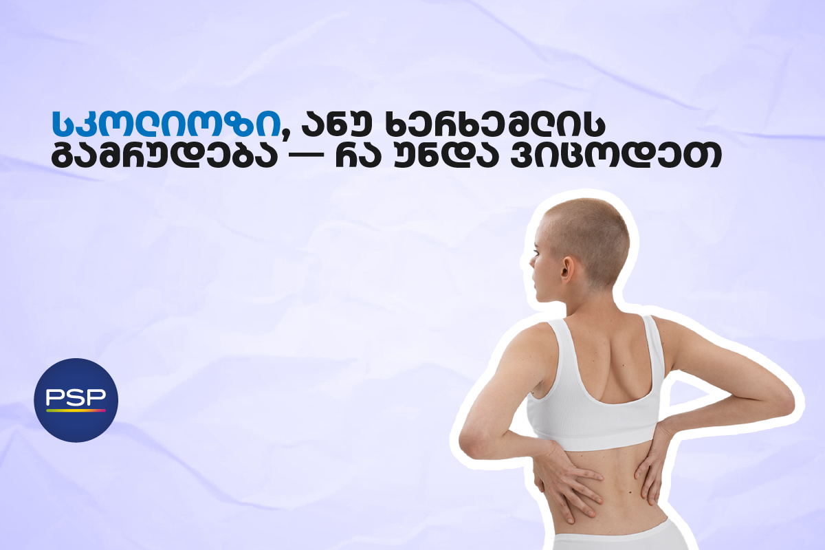 სკოლიოზი, ანუ ხერხემლის გამრუდება — რა უნდა ვიცოდეთ