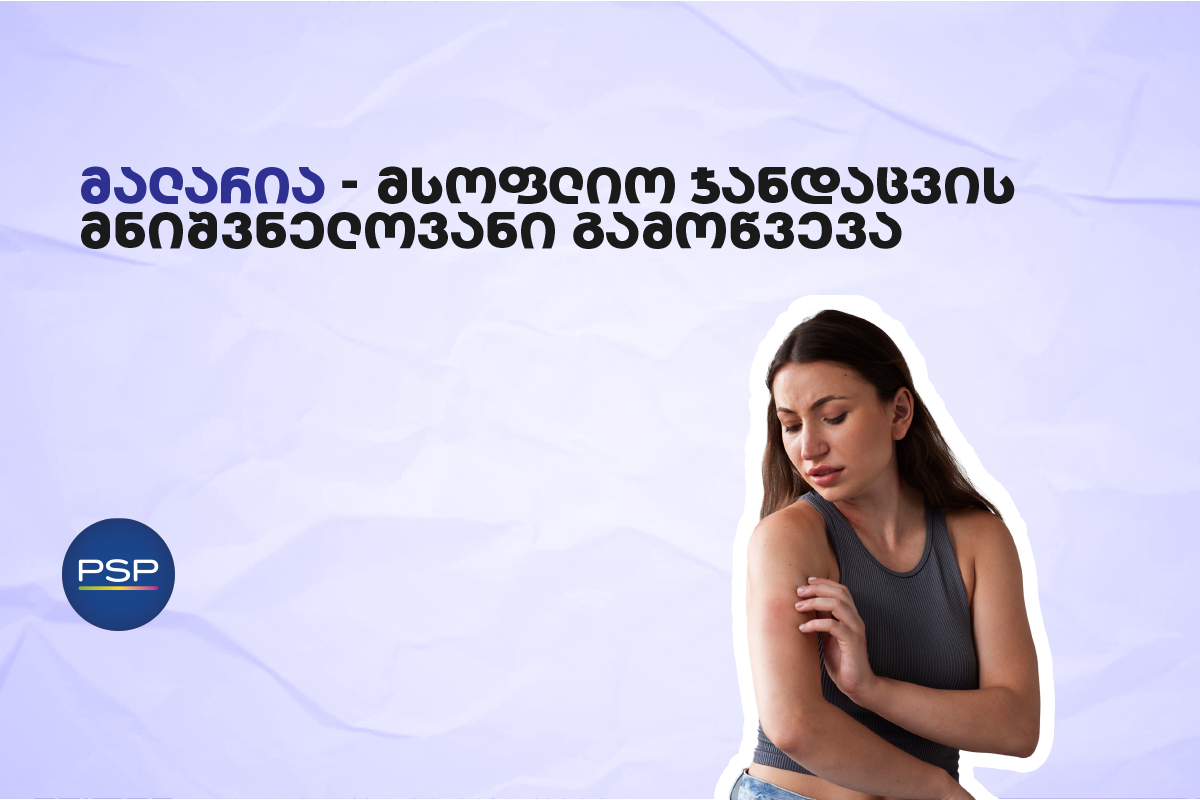 მალარია — მსოფლიო ჯანდაცვის მნიშვნელოვანი გამოწვევა