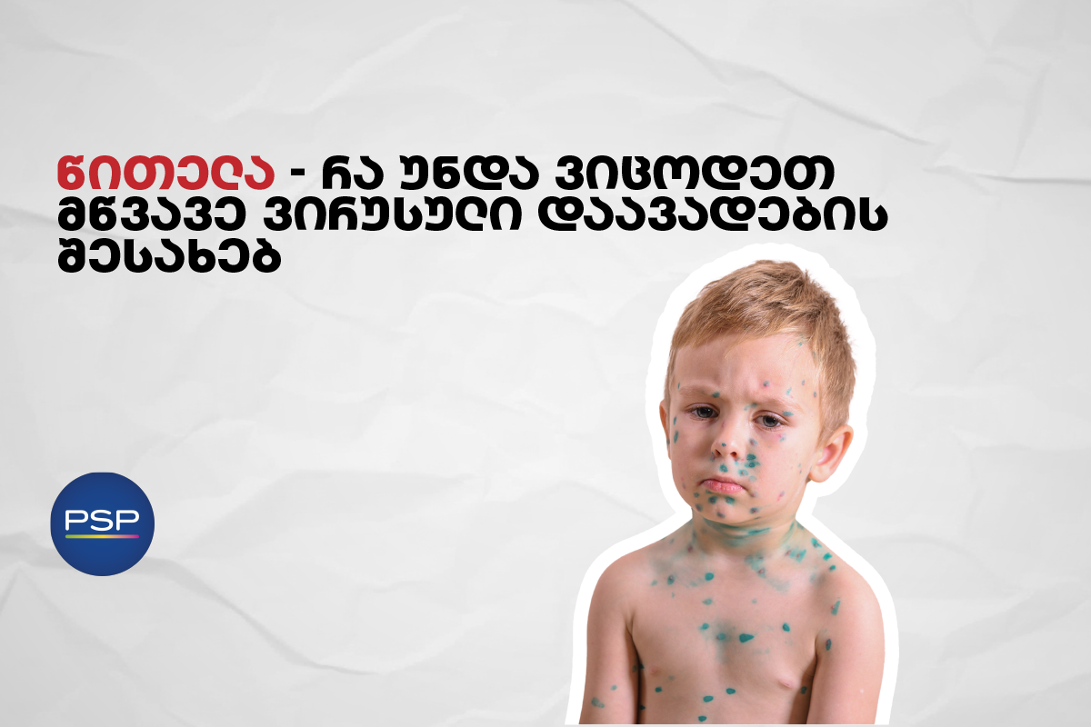 წითელა — რა უნდა ვიცოდეთ მწვავე ვირუსული დაავადების შესახებ 