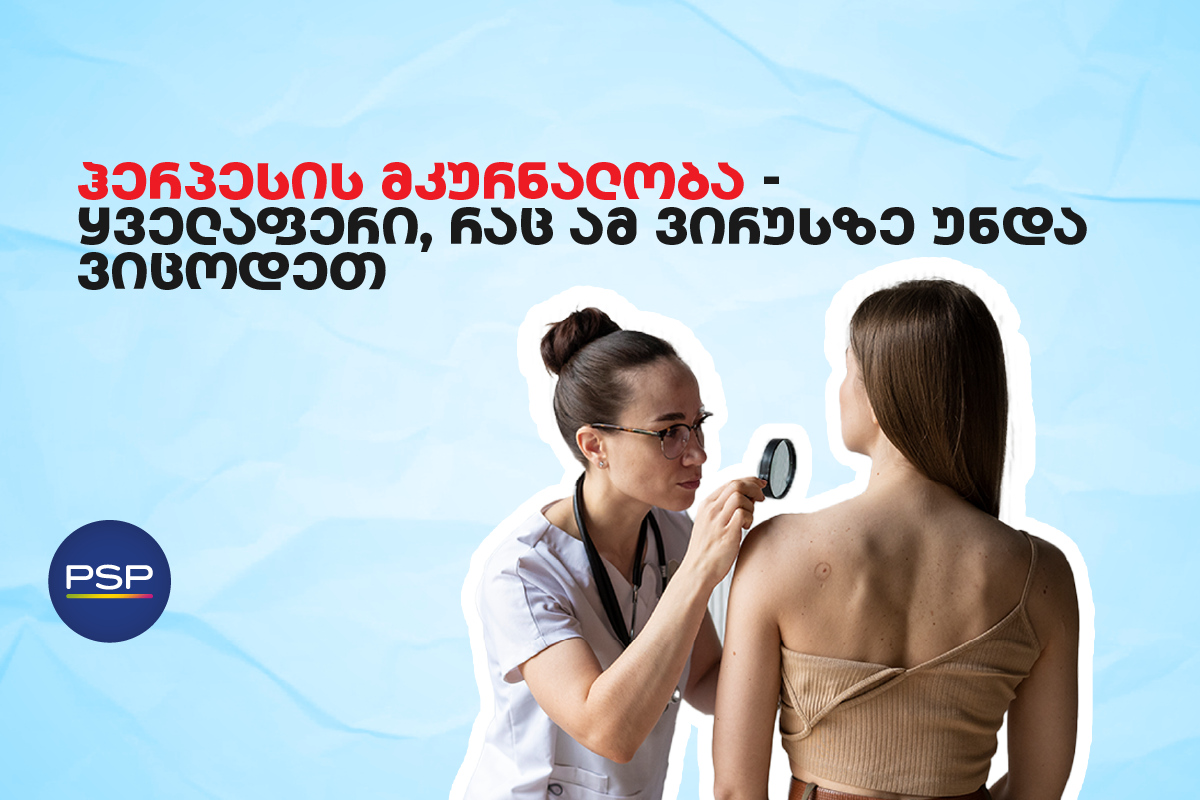 ჰერპესის მკურნალობა — ყველაფერი, რაც ამ ვირუსზე უნდა ვიცოდეთ