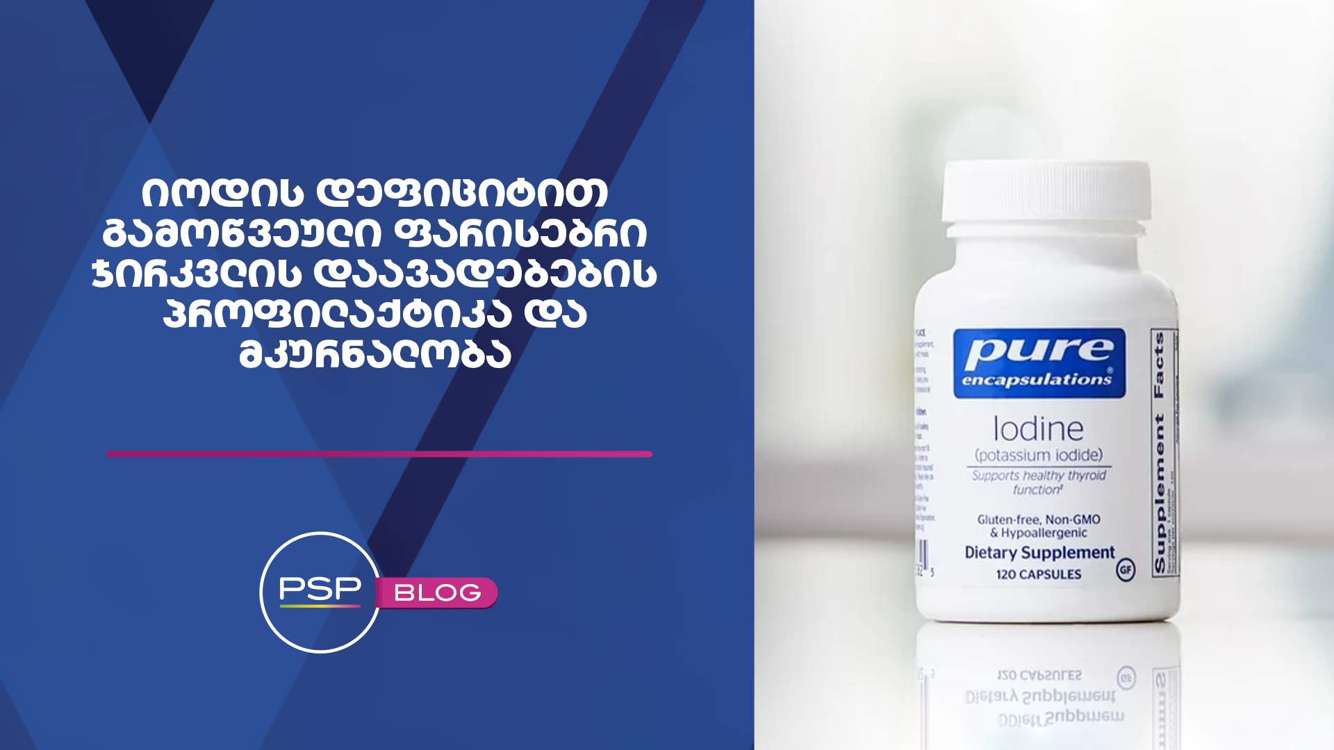 იოდის დეფიციტით გამოწვეული ფარისებრი ჯირკვლის დაავადებების პროფილაქტიკა და მკურნალობა