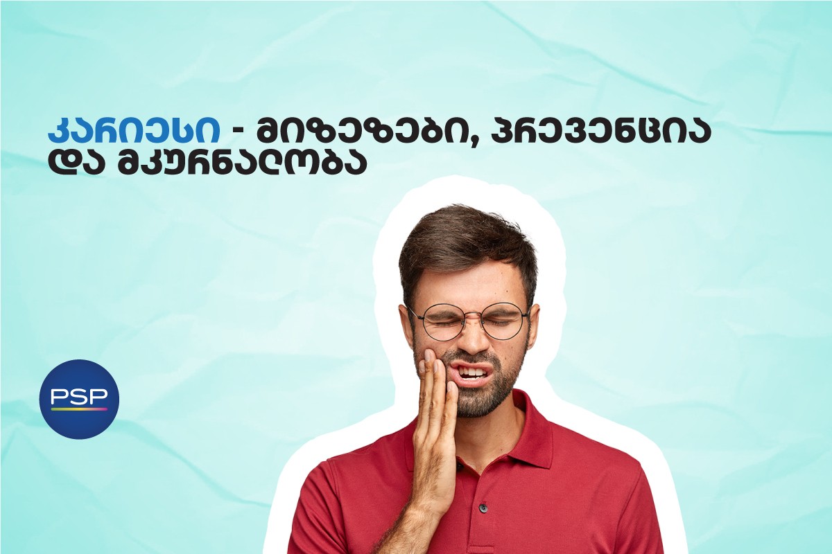 კარიესი — მიზეზები, პრევენცია და მკურნალობა 