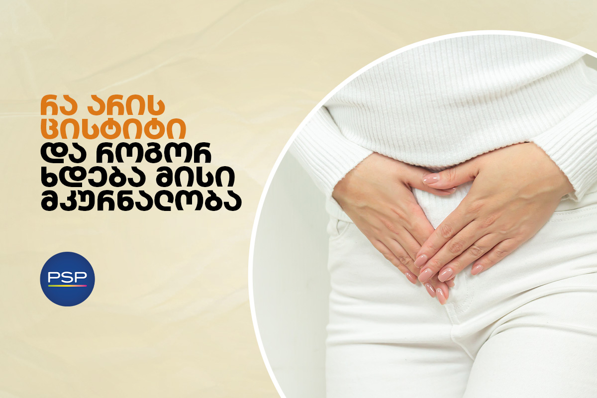 რა არის ცისტიტი და როგორ ხდება მისი მკურნალობა