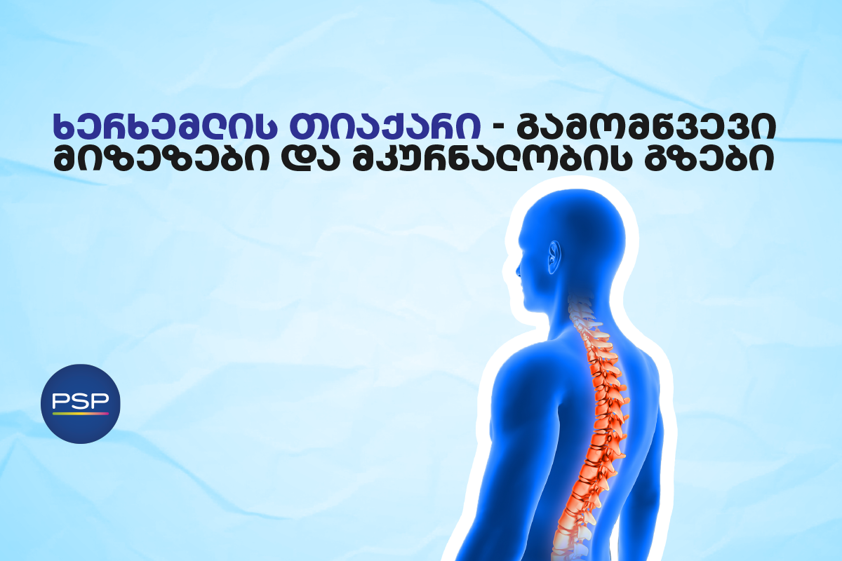 ხერხემლის თიაქარი – გამომწვევი მიზეზები და მკურნალობის გზები