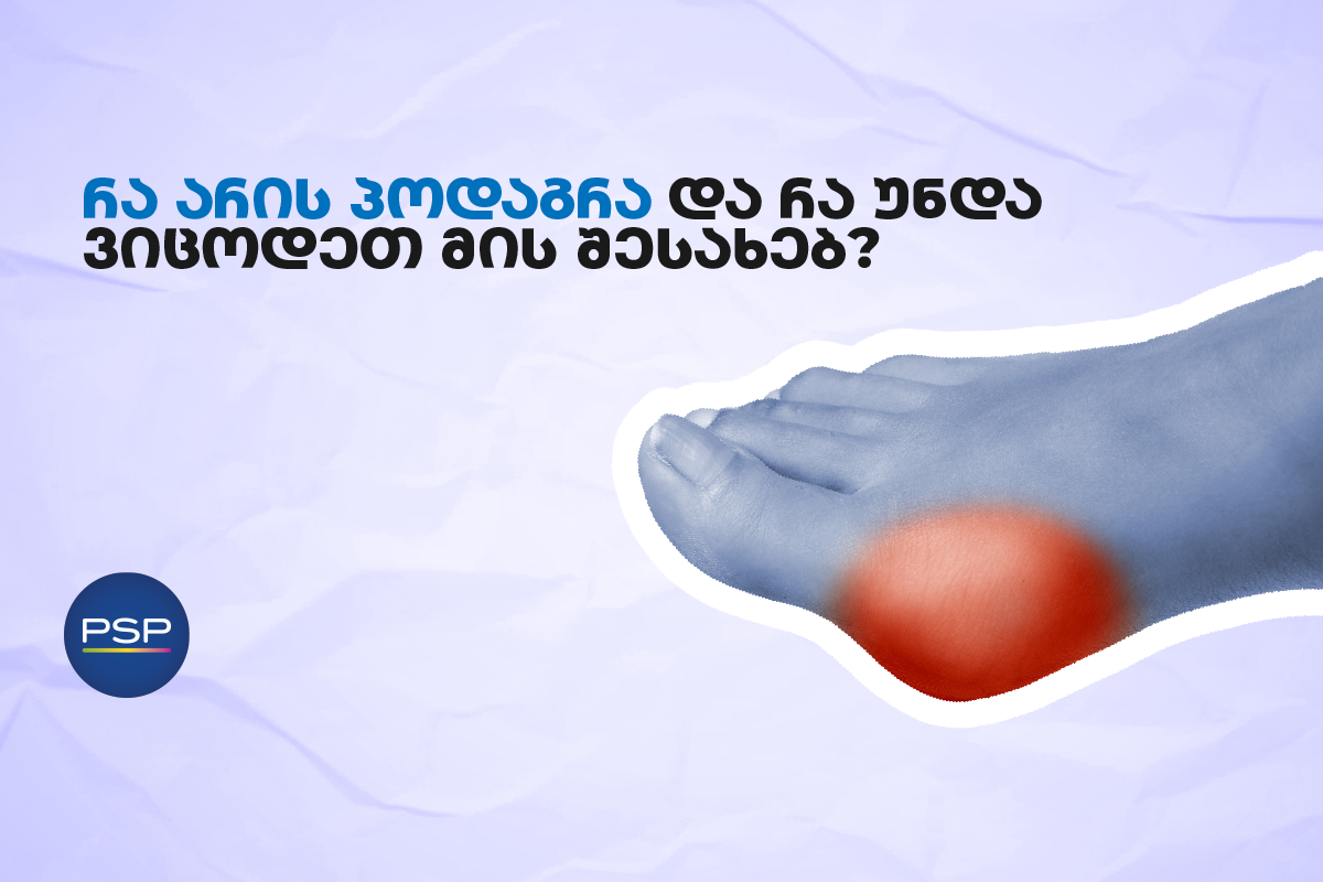 რა არის პოდაგრა და რა უნდა ვიცოდეთ მის შესახებ? 