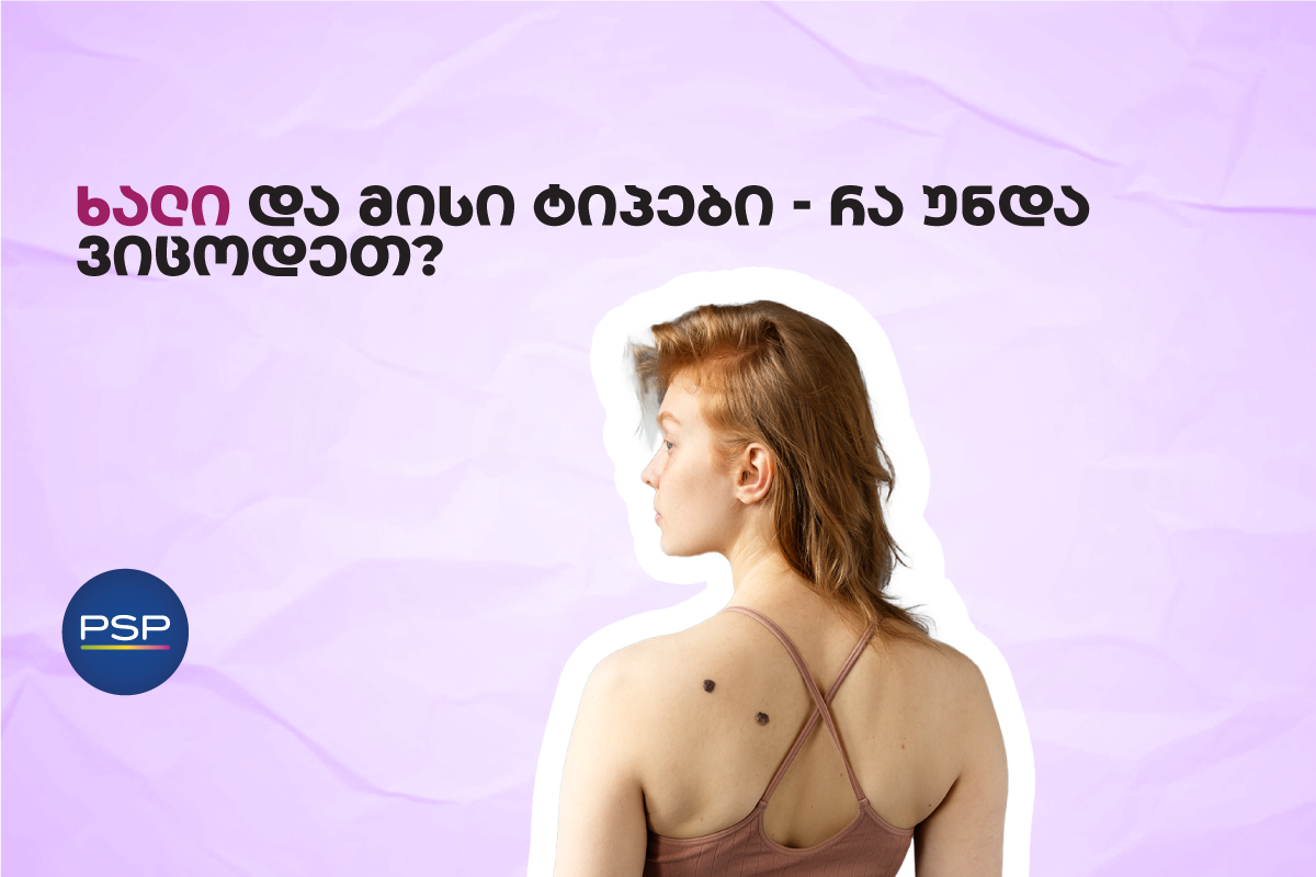 ხალი და მისი ტიპები — რა უნდა ვიცოდეთ?