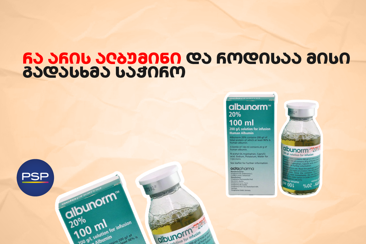 რა არის ალბუმინი და როდისაა მისი გადასხმა საჭირო